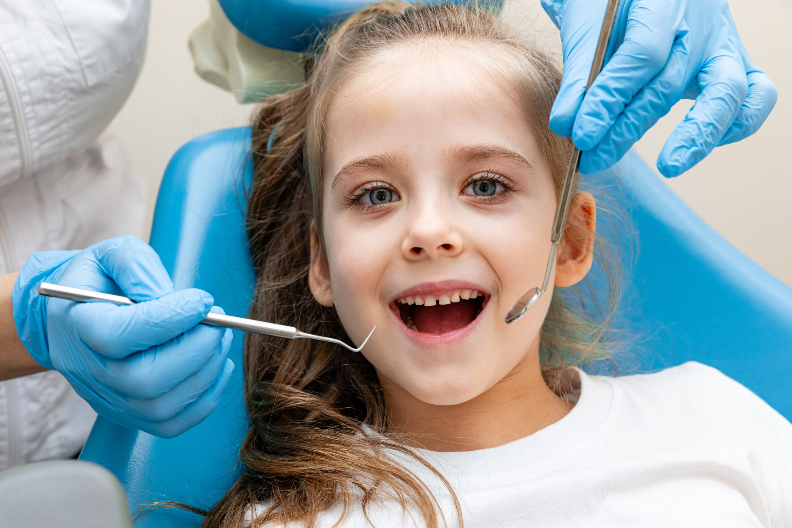 dentist, doctor examines the oral cavity of a little girl, uses a mouth mirror, baby teeth close-up, the concept of pediatric dentistry, dental treatment.